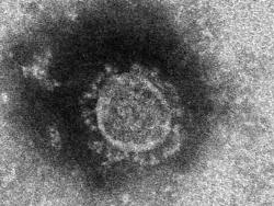 半導体業界、コロナ禍でも力強さ、リモート浸透で需要拡大、在庫補充も影響