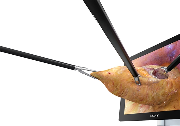 電子デバイス技術が内視鏡にイノベーションを呼ぶ 電子デバイス産業新聞 旧半導体産業新聞